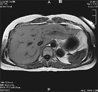 Магнитно резонансная томография мрт в санкт петербурге