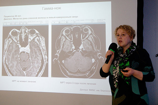Королева Надежа Юрьевна рассказывает о возможностях лечения онкологии в МИБС